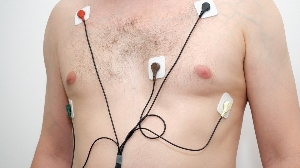 MAPA de presión arterial 24 h manguito automático mide tensión día y noche para diagnosticar hipertensión