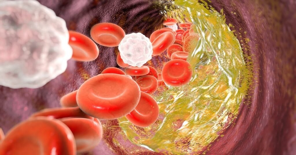 Illustration of artery showing reduction of LDL cholesterol.